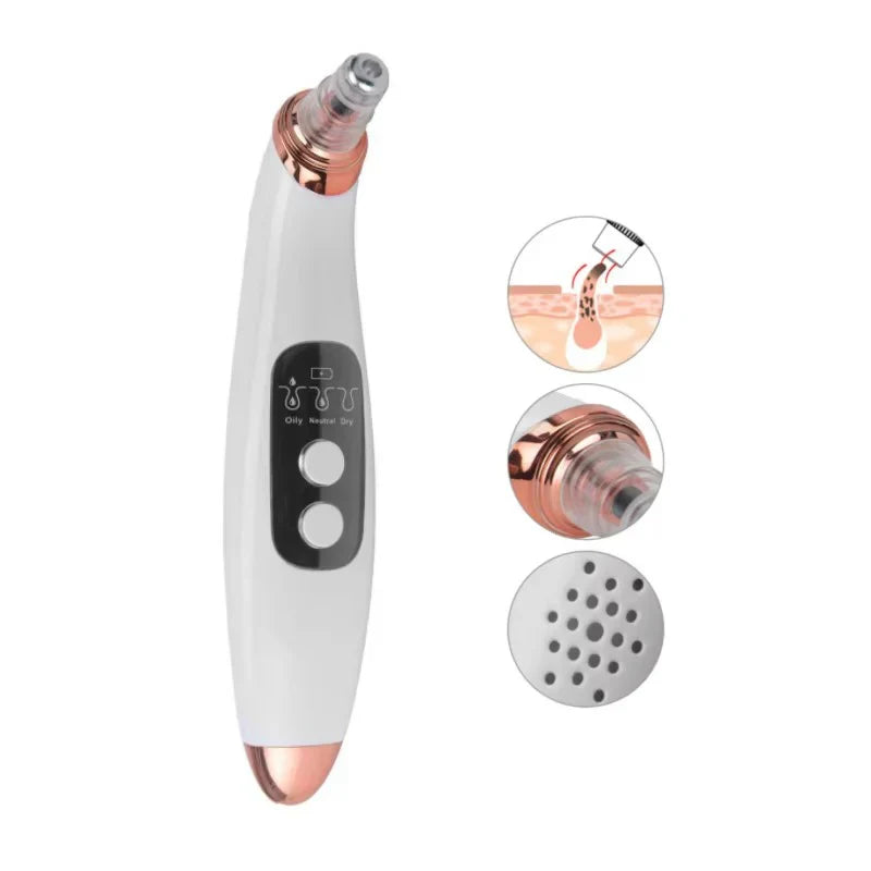Electric blackhead remover