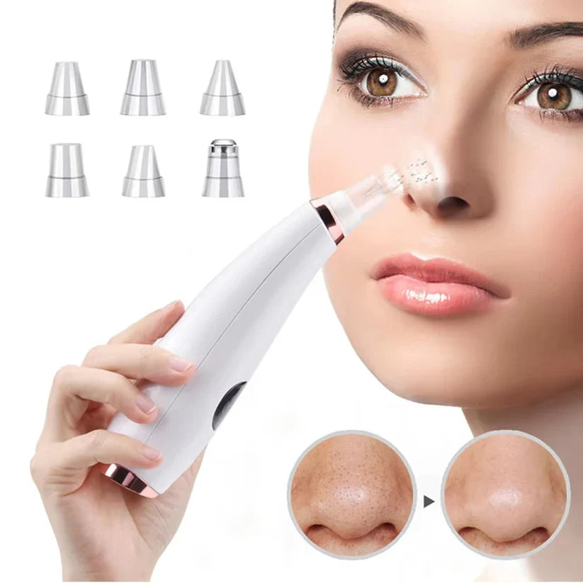 Electric blackhead remover